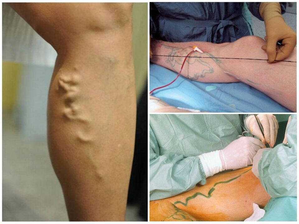 cirurgia