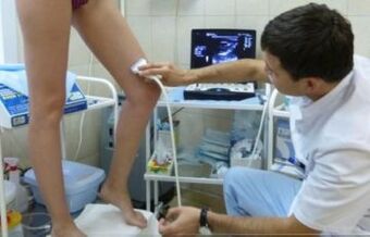 Ultrassom para identificar veias afetadas